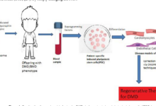 Gene therapy dmd elevidys