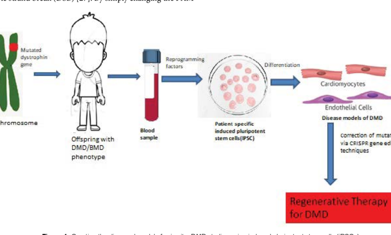 Gene therapy dmd elevidys