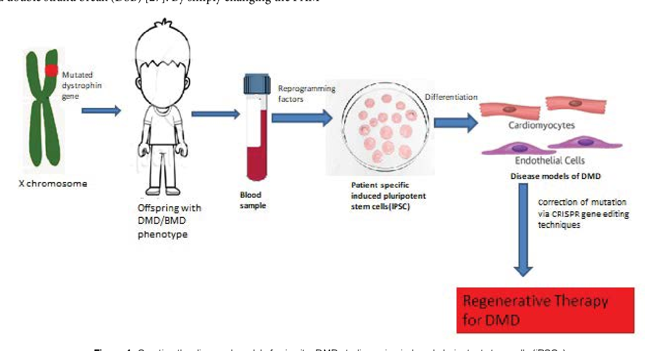 Gene therapy dmd elevidys