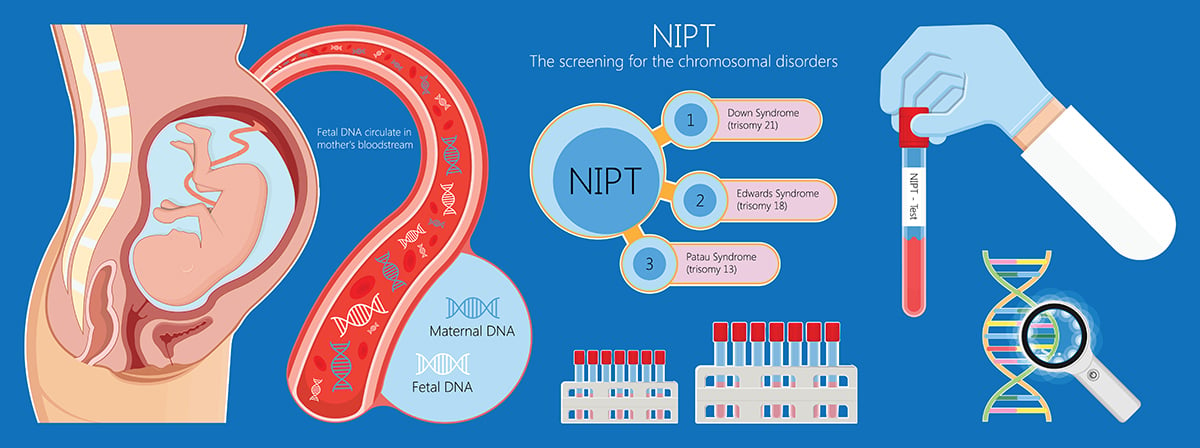 Prenatal testing downsyndrome ethics